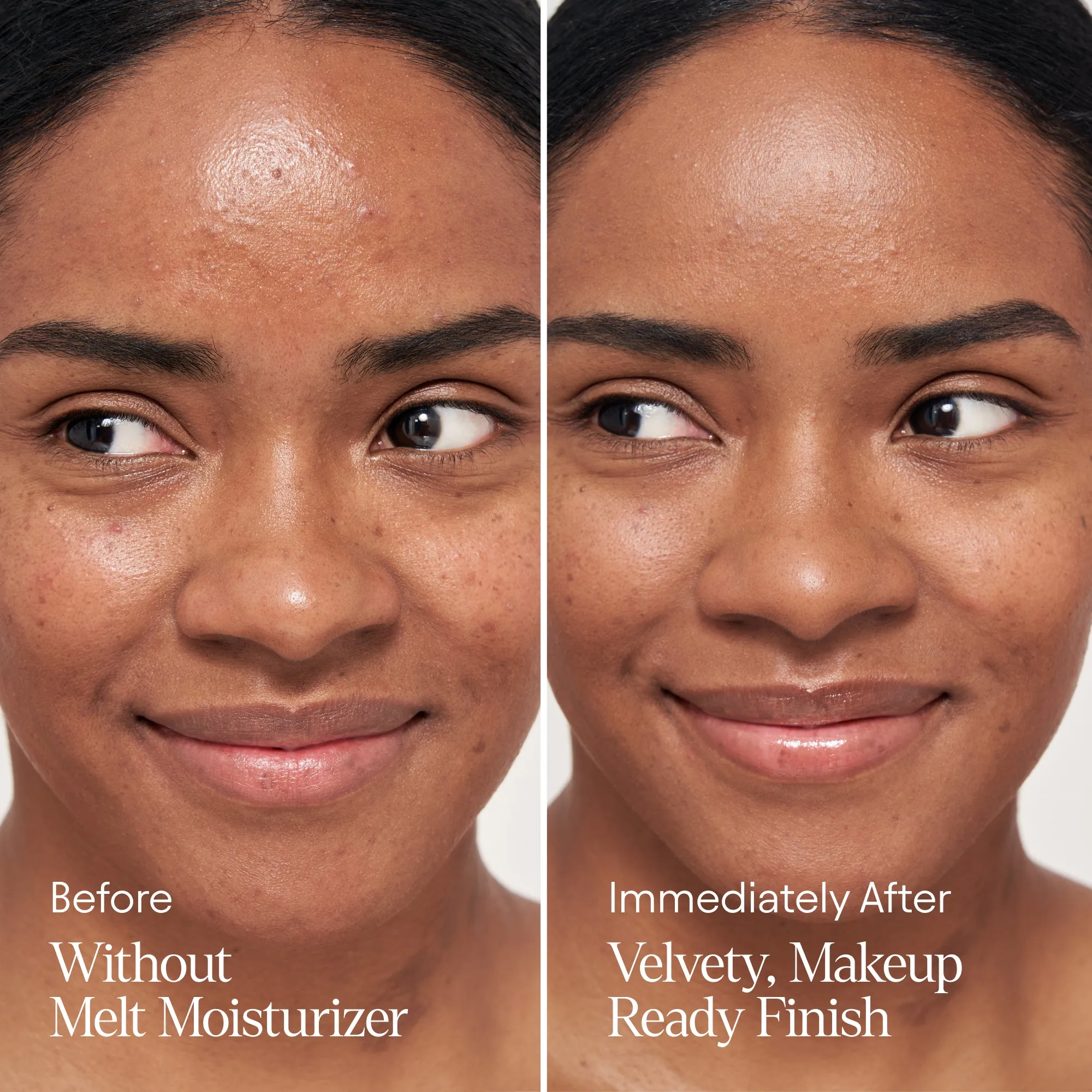 Melt Moisturizer